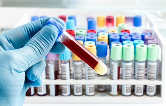 LUX Medical Center in house laboratories Miami Hollywood Florida
